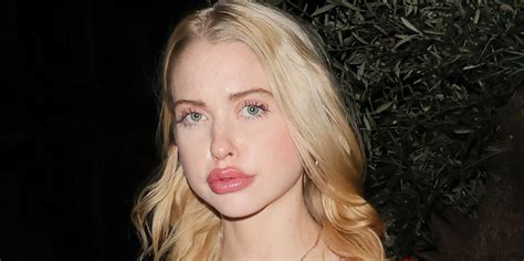 chloe cherry lips are fake|‘Euphoria’ actor Chloe Cherry responds to comments about her lips.